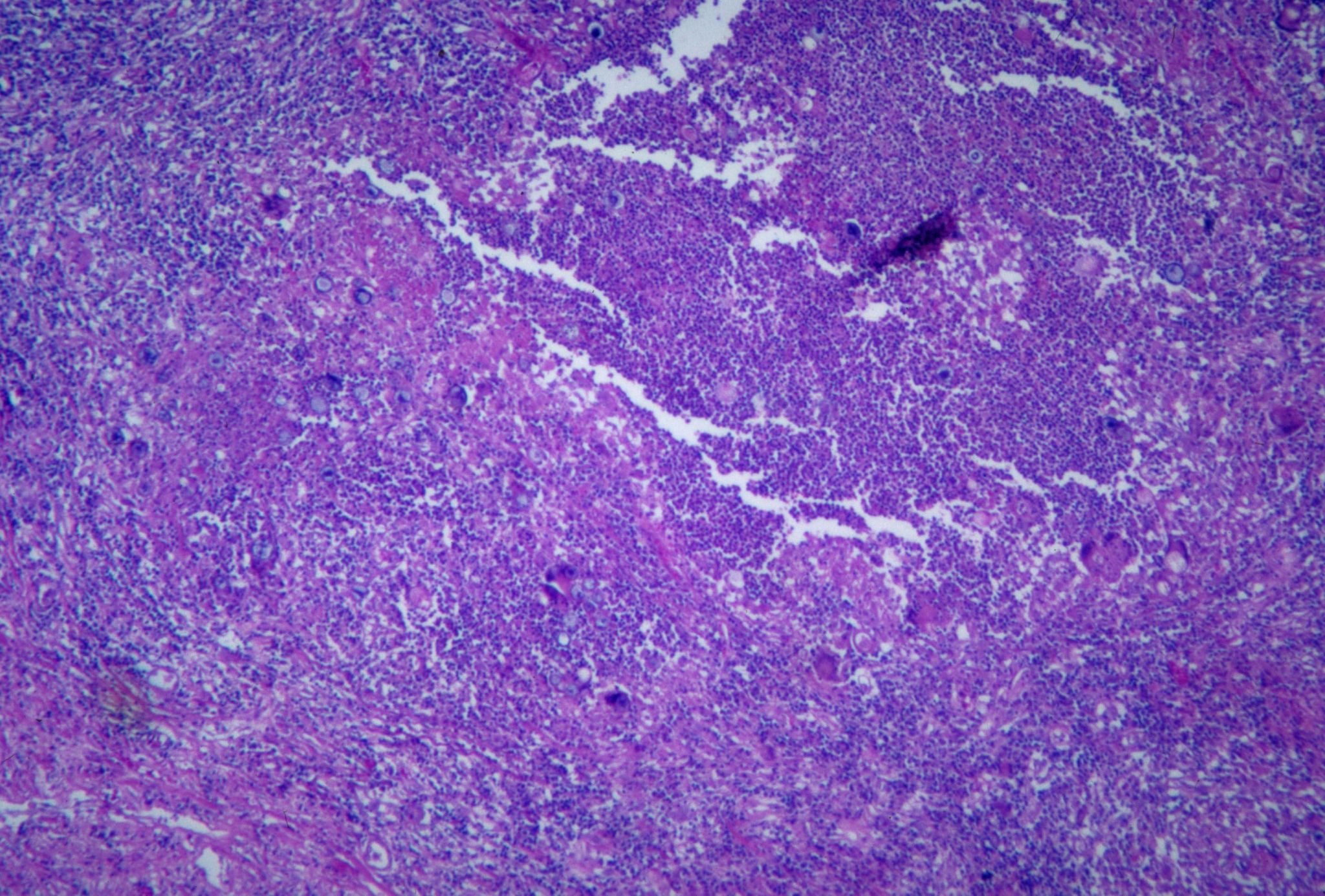 Фото Актиномикоза Молочной Железы — Mixyfotos.ru