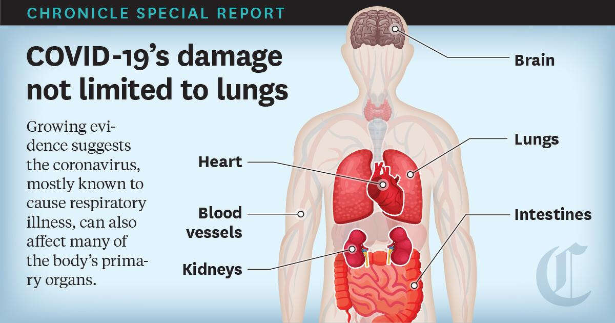 How COVID-19 can affect most major organs, not just the lungs