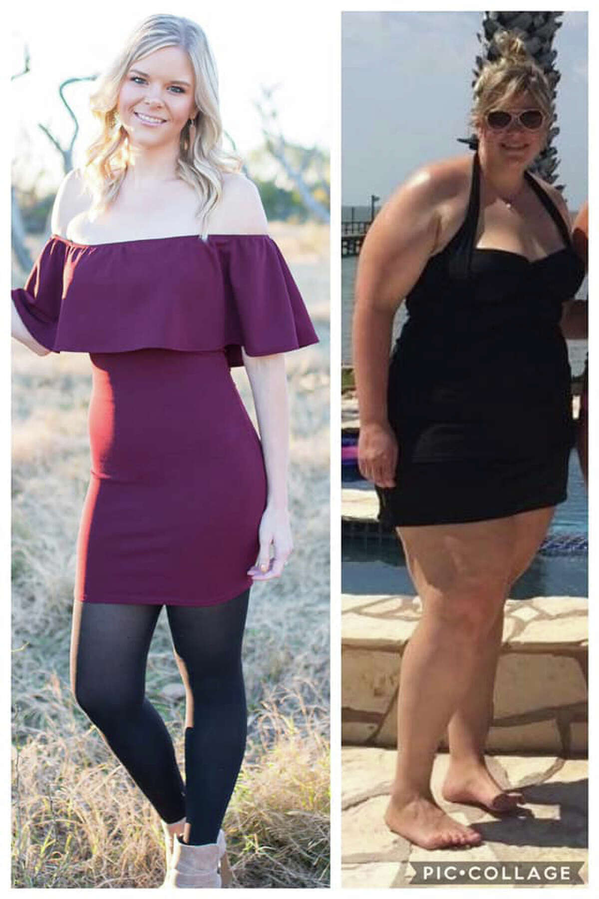 Alexis Moczygemba shows off her weight loss transformation from 309 pounds to 145 pounds.