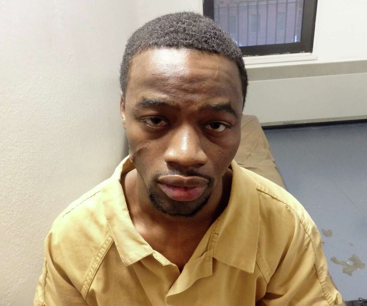 Albany County jail records indicate this photo of Davon Washington was taken at 7:18 p.m. on March 28, 2018, less than five hours after security video footage showed Washington being brought into the jail from Rikers Island in New York City. In a federal lawsuit, Washington alleges several Albany County correction officers beat him so severely during his booking process that ?’his face was swollen, his tooth was chipped, his lip was split.?“ (Albany County Sheriff?•s Department)
