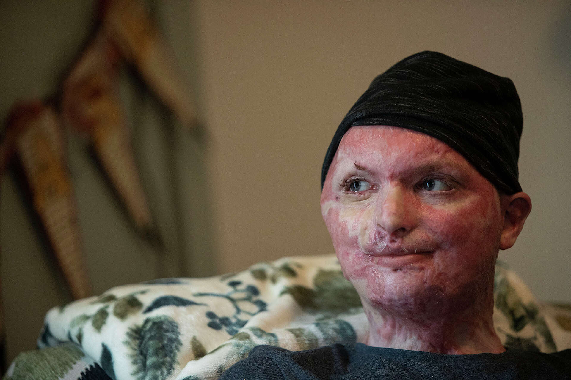 A fire killed his friends. A leap saved his life. After 23