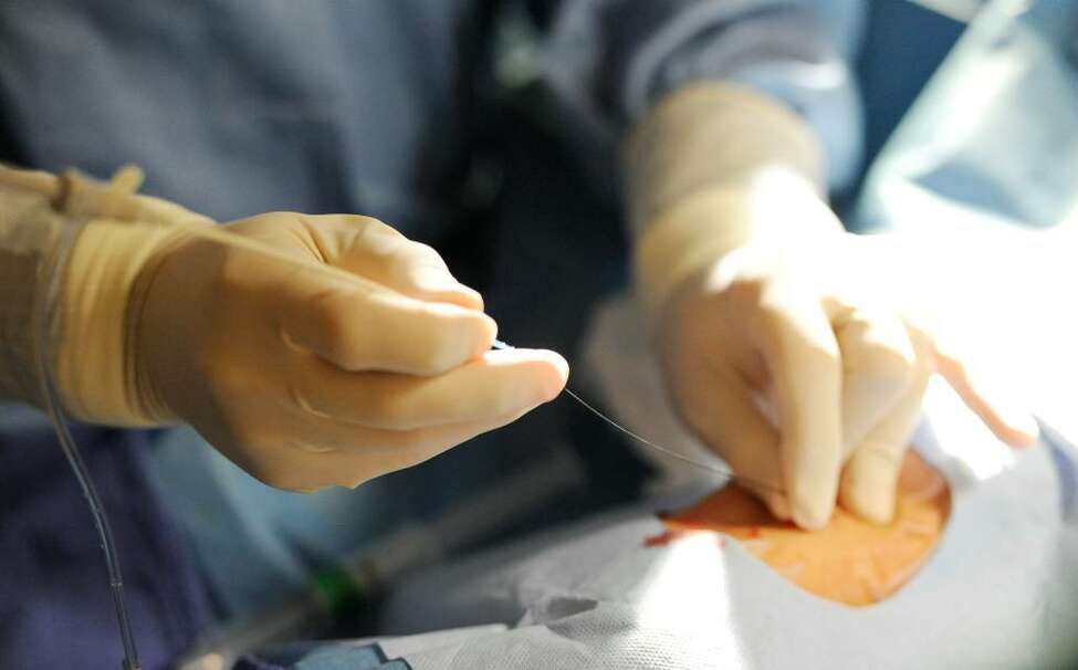 New path to heart gets more popular at area hospitals