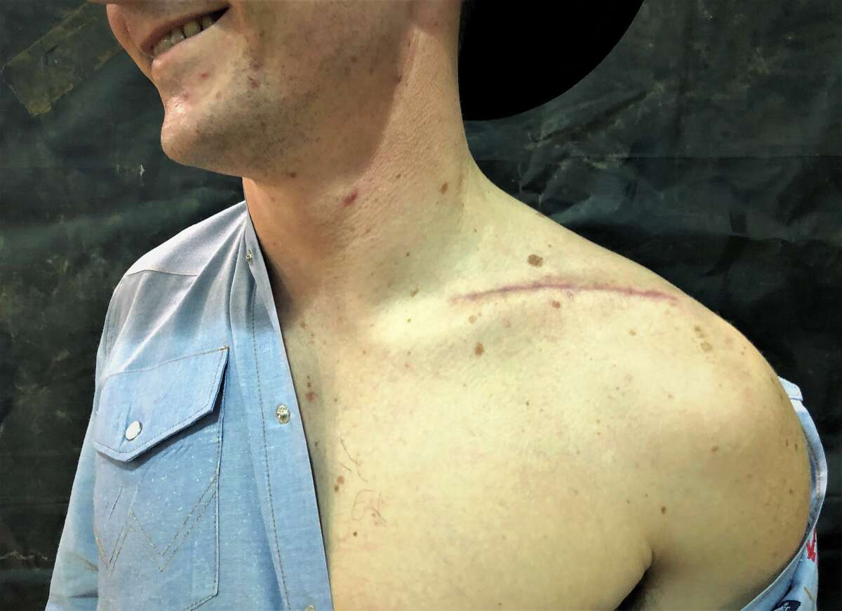 We asked rodeo cowboys to show us their scars. Here's what we saw