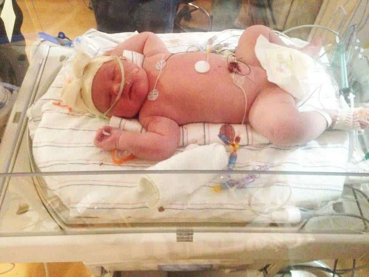 New York Woman Gives Birth To 15 Pound Baby Girl
