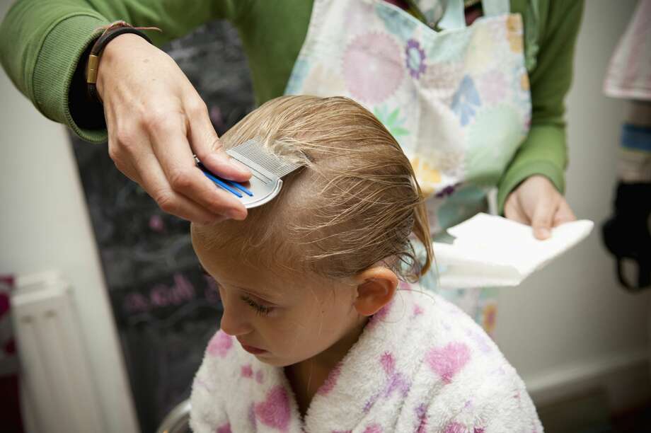 Dear Abby Man Ignores Lice Infestation Found In Daughter S Hair