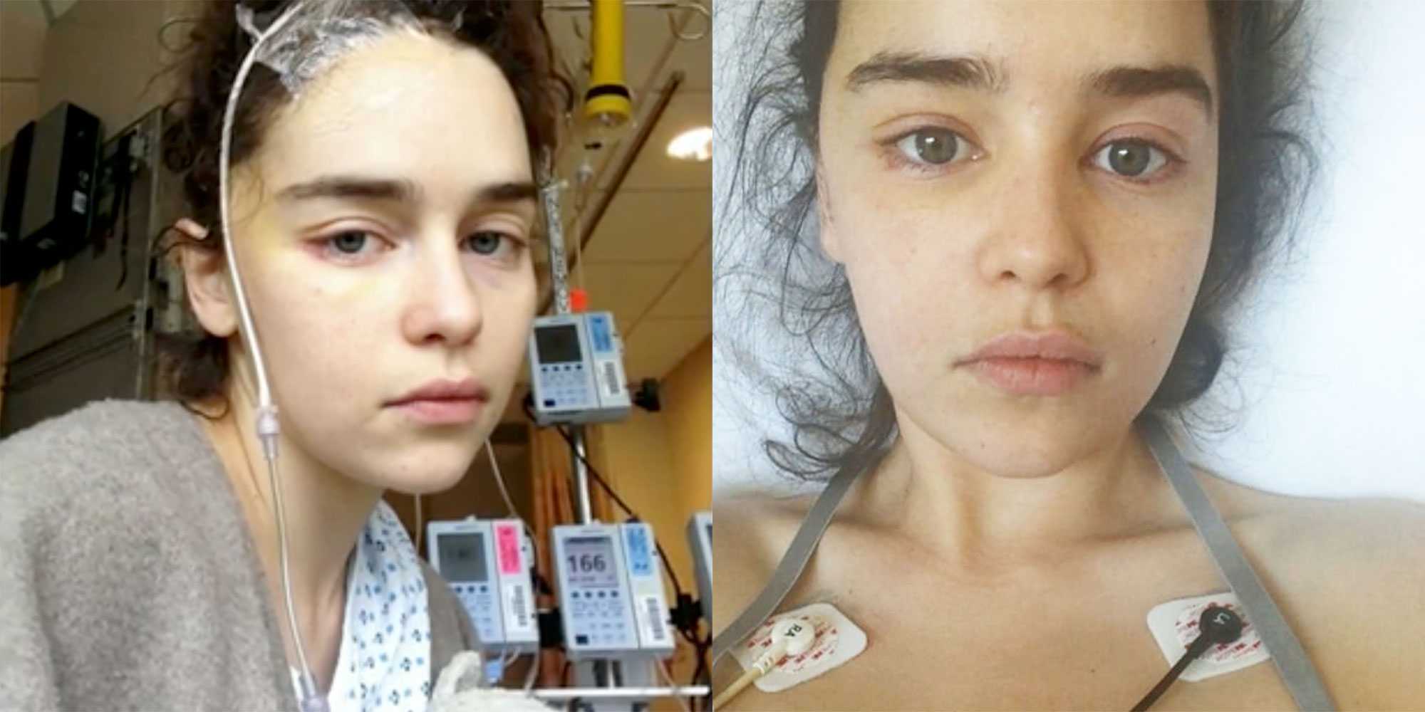 Emilia Clarke shares never-before-seen photos of herself after brain
