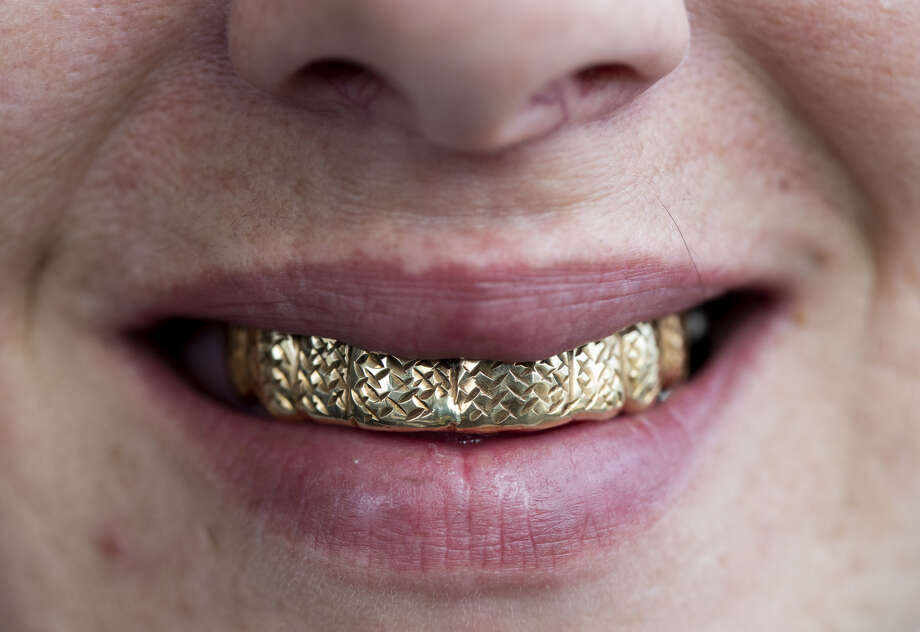 Lisa Mathis, 39, lost her front teeth after a pimp allegedly attacked her with a hammer in 2010. "He tortured me so bad...and my head was so big I looked like the Elephant Man," she said. Photo: Godofredo A. Vásquez, Staff Photographer
