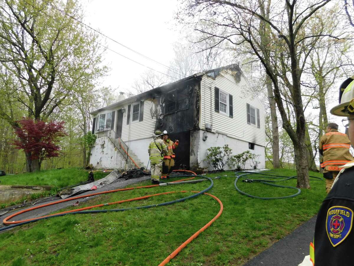 Ridgefield garage fire sends one to the hospital for burns
