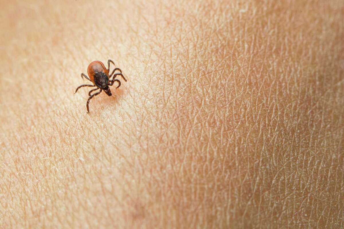 how-to-avoid-ticks-and-what-to-do-if-you-get-bitten-shots-health