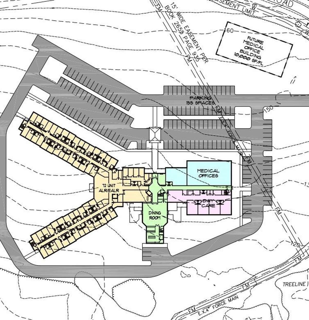 Assisted living facility eyed for Glenmont