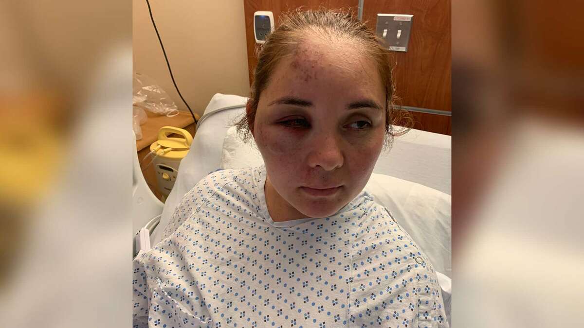 Mom beaten and knocked unconscious by son's 13-year-old bully, family says