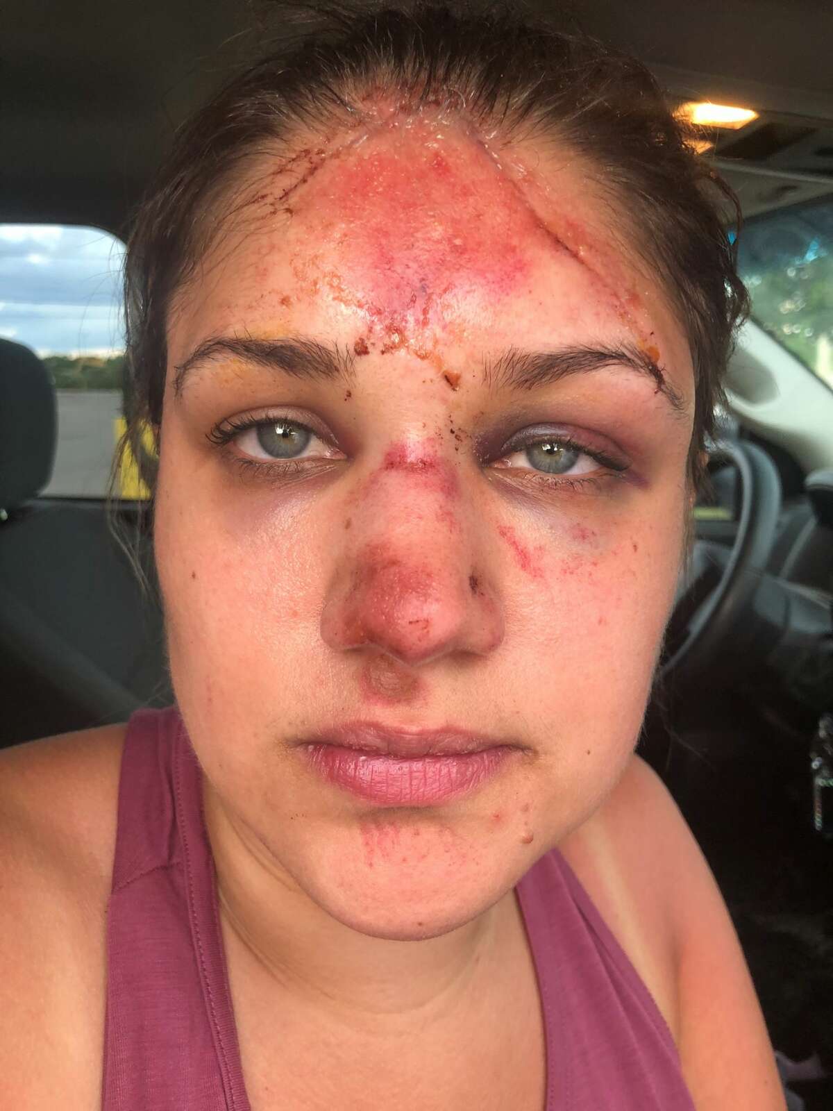 Texas woman says she was attacked over a tube in New Braunfels
