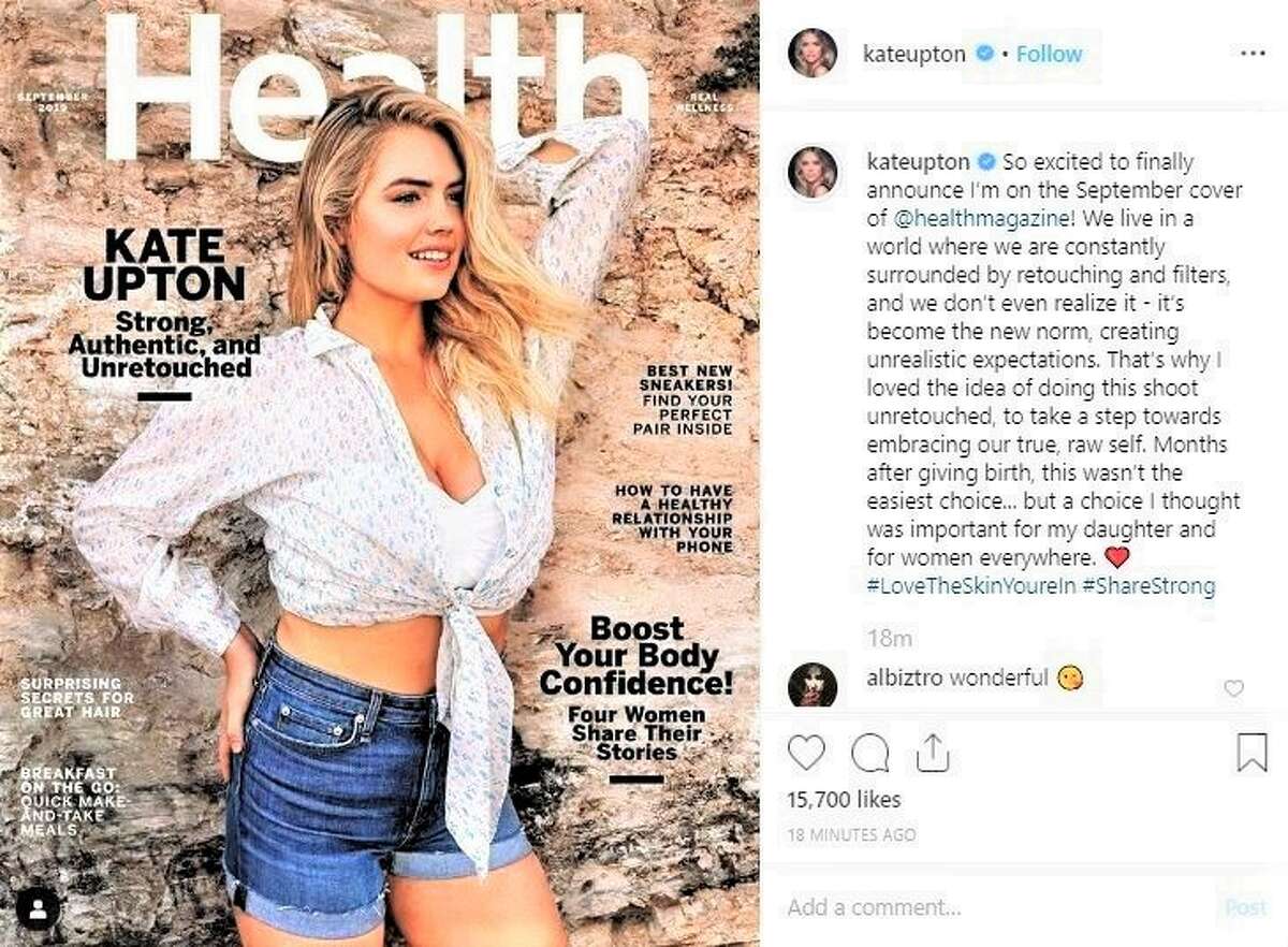 Kate Upton Nixes Retouched Photos For Body Positivity Shoot In Health Magazine