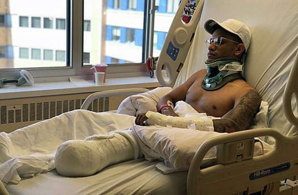 The family of a Bridgeport man, who lost a leg in a Merritt Parkway hit and run crash, is seeking donations to help his recovery. Ronal Perez, 28, the owner of a Bridgeport barber shop, was riding his motorcycle on the Merritt Parkway around 9:30 p.m. Aug. 11, 2019 when he was struck by a hit and run driver.