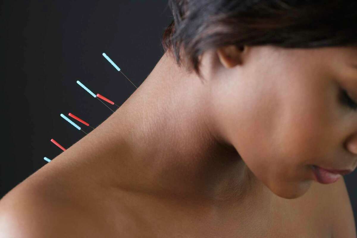 Amerigroup said that acupuncture was the wellness benefit most Medicare Advantage members selected last year. The federal government has relaxed rules allowing companies to add even more wellness benefits such as transportation and pest control.