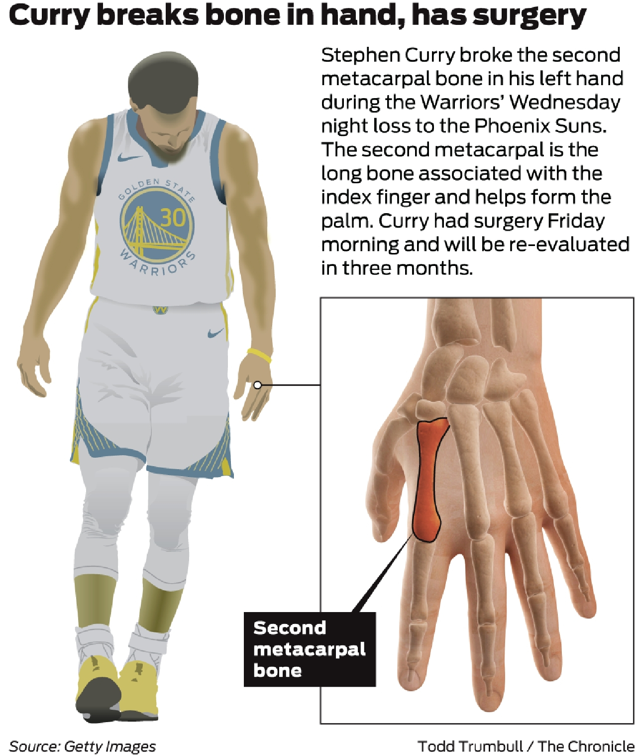 Operado da mão esquerda, Stephen Curry desfalcará Warriors por pelo menos 3  meses - Superesportes