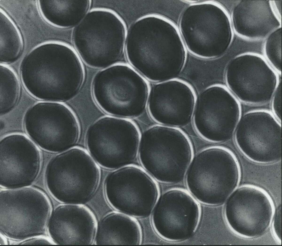 Body-human Red blood cells are pictured floating freely in blood plasma. They are so small that a row of 150 would be about 1/25 of an inch long, but there are so many red blood cells in the body that if arranged in a line they would stretch four times around the equator.
