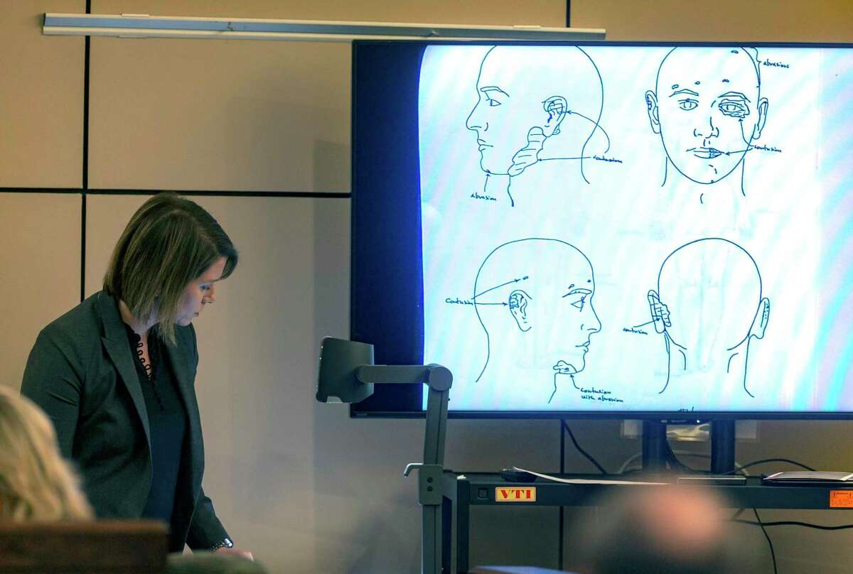 Prosecutor Alessandra Cranshaw displays a diagram Wednesday, Dec. 4, 2019, in the 144th state District Court in the Cadena-Reeves Criminal Justice Center during the murder trial of Mark Howerton of injuries found on Cayley Mandadi?•s head. Howerton is alleged to have beaten Mandadi, a 19-year-old Trinity University cheerleader, to death in 2017.