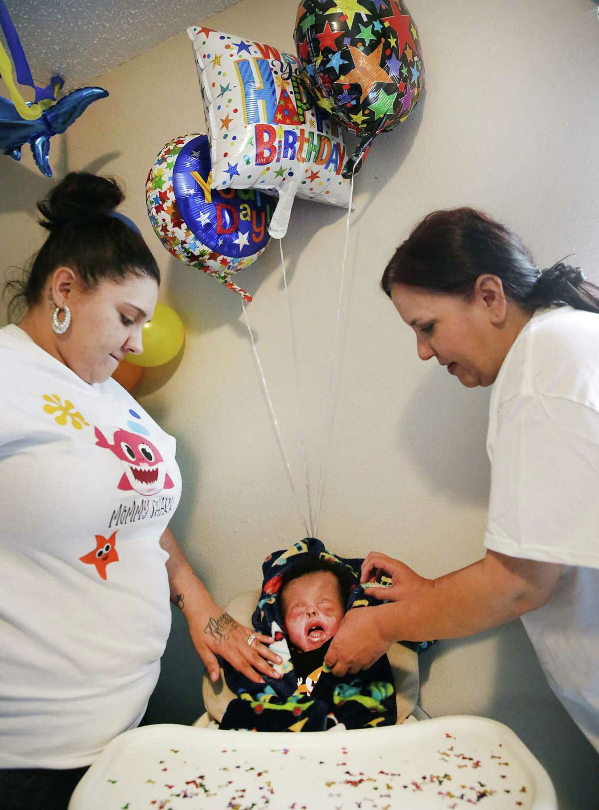 Ja’bari Gray, the baby born without skin, celebrates his first birthday(02)