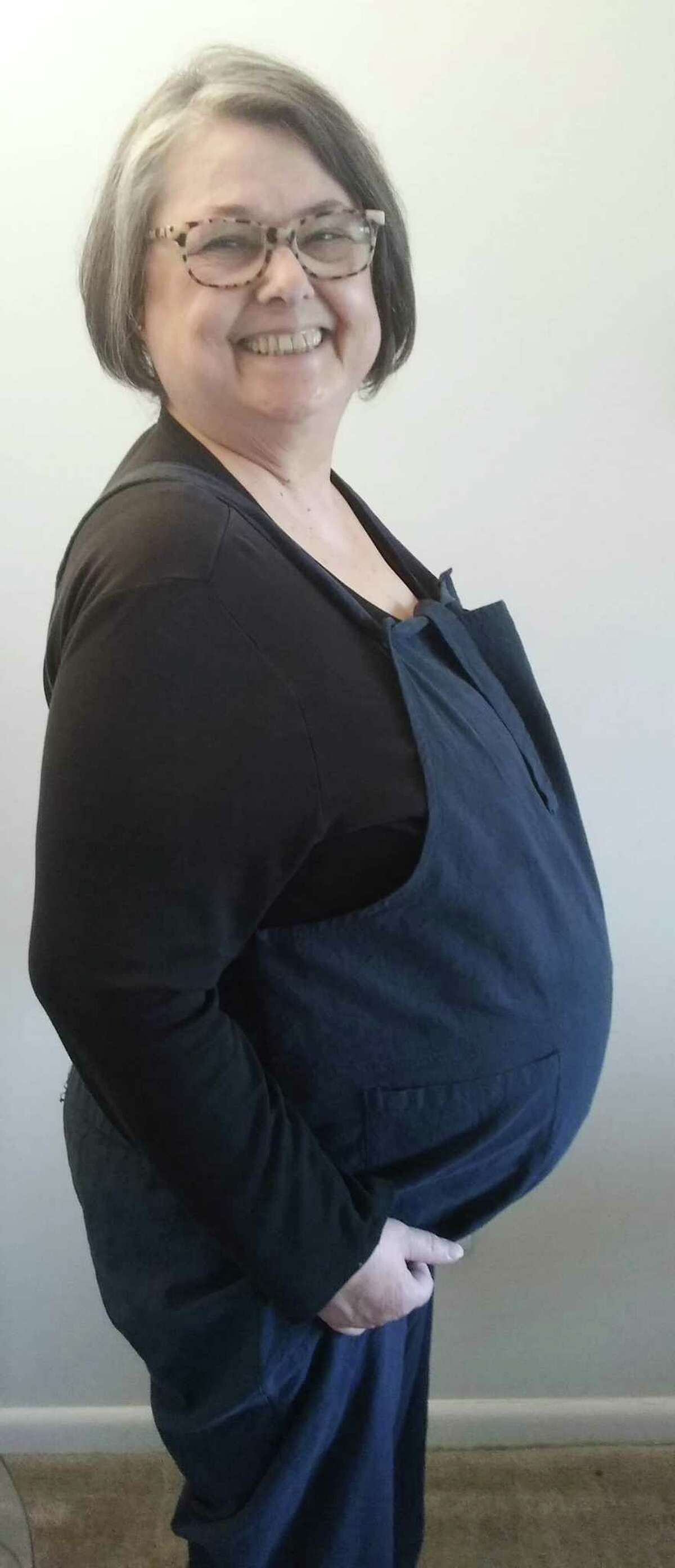 Karen Smyrski-Smith is shown above in September of 2019. Her belly is due to the progression of Autosomal Dominant Polycystic Kidney Disease.