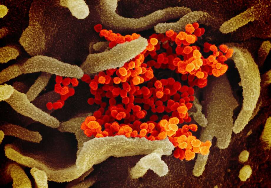 In this image from a scanning electron microscope, the new coronavirus is in orange. Photo: Elizabeth Fischer / Courtesy NiAID