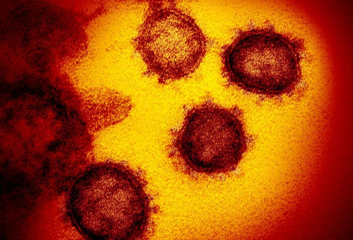A transmission electron microscope captured this image of the SARS-CoV-2 coronavirus, which has a distinctive crown-like appearance. SARS-CoV-2 is the virus that causes COVID-19. On Friday, March 20, 2020. A San Francisco telehealth startup launched a test it developed for COVID-19. Initially it will cost $181.