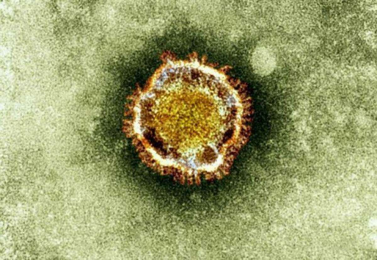 Houston and Harris County have seen no confirmed cases of coronavirus, public health officials said Tuesday.