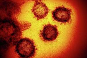 Fort Bend coronavirus case is first in Houston area