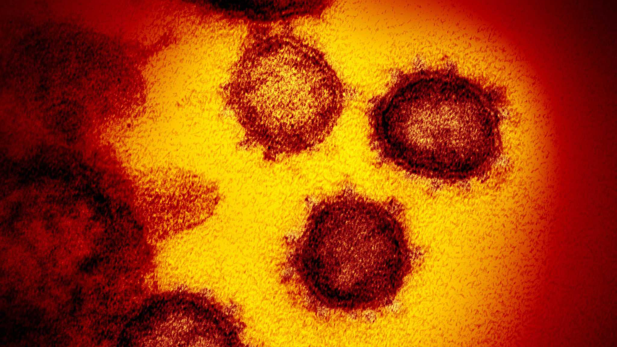 Texas Coronavirus Map See The Latest Numbers On Our Interactive