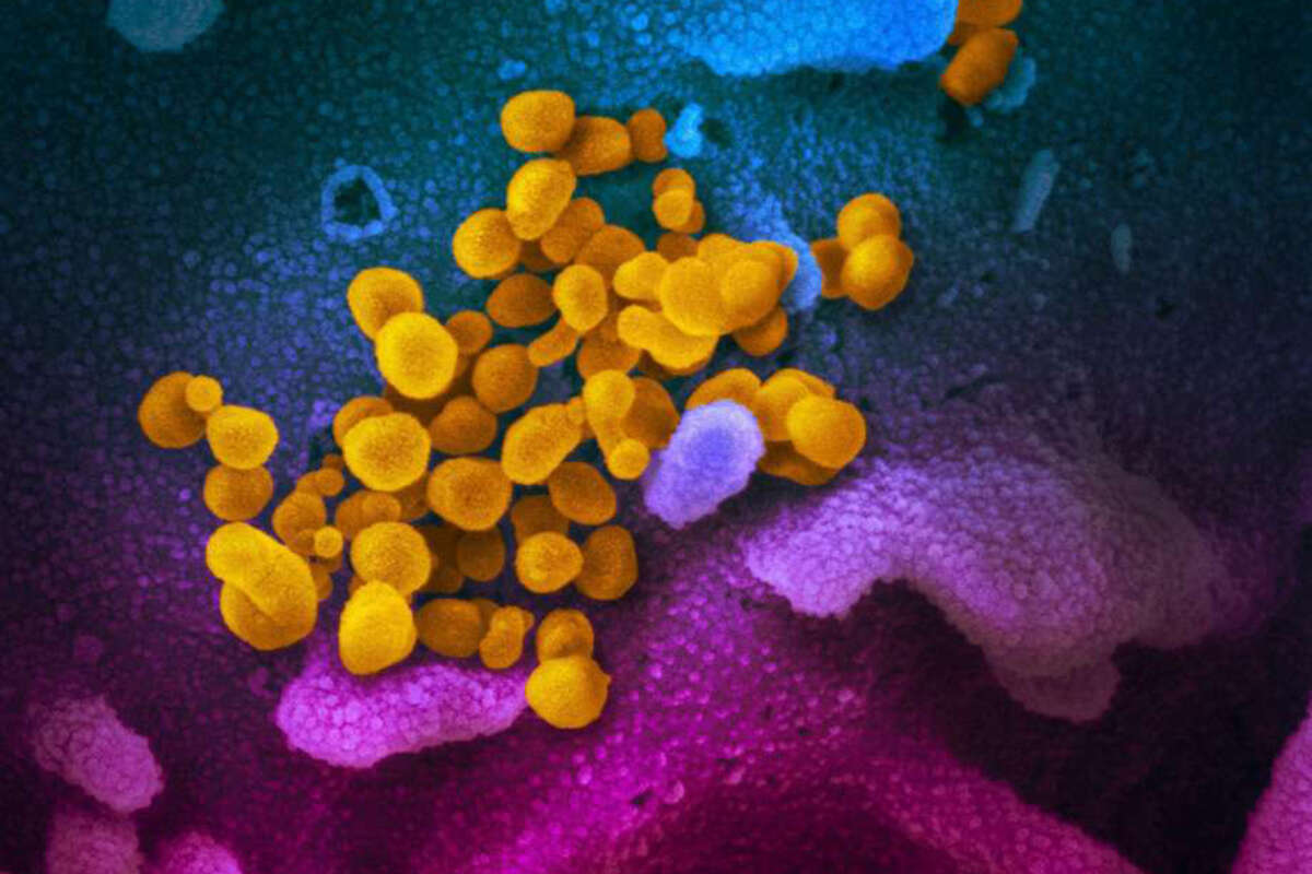 This file photo handout illustration image obtained recently courtesy of the National Institutes of Health taken with a scanning electron microscope shows SARS-CoV-2 (yellow)also known as 2019-nCoV, the virus that causes the disease COVID-19 isolated from a patient in the U.S., emerging from the surface of cells (blue/pink) cultured in the lab.