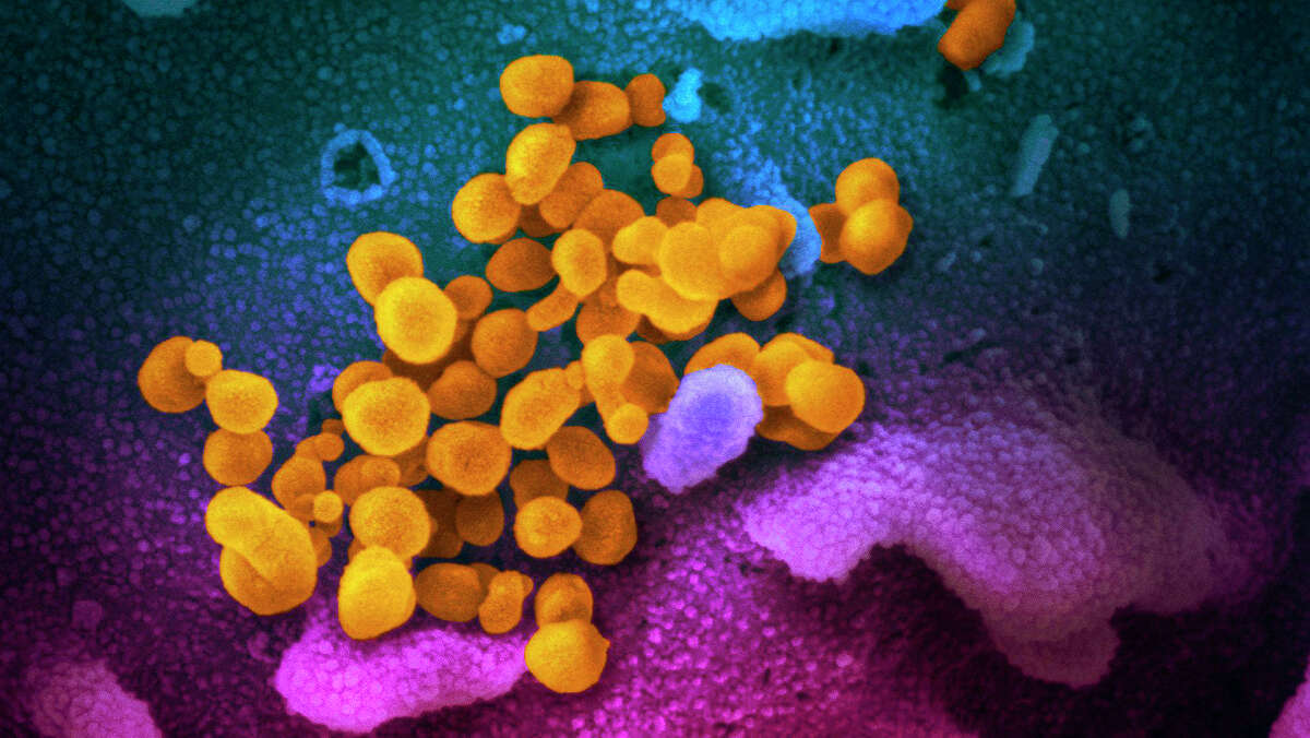 This file photo handout illustration image obtained recently courtesy of the National Institutes of Health taken with a scanning electron microscope shows the virus that causes the disease COVID-19 isolated from a patient in the U.S., emerging from the surface of cells (blue/pink) cultured in the lab.