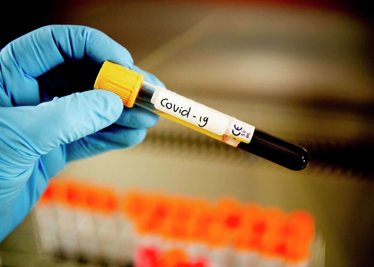 This test tube contains a blood sample from a patient who tested positive for the COVID-19 coronavirus at Amphia Hospital in Breda, Netherlands. As of March 20, the hospital was carrying out between 400 and 500 tests a day for suspected cases of the virus.