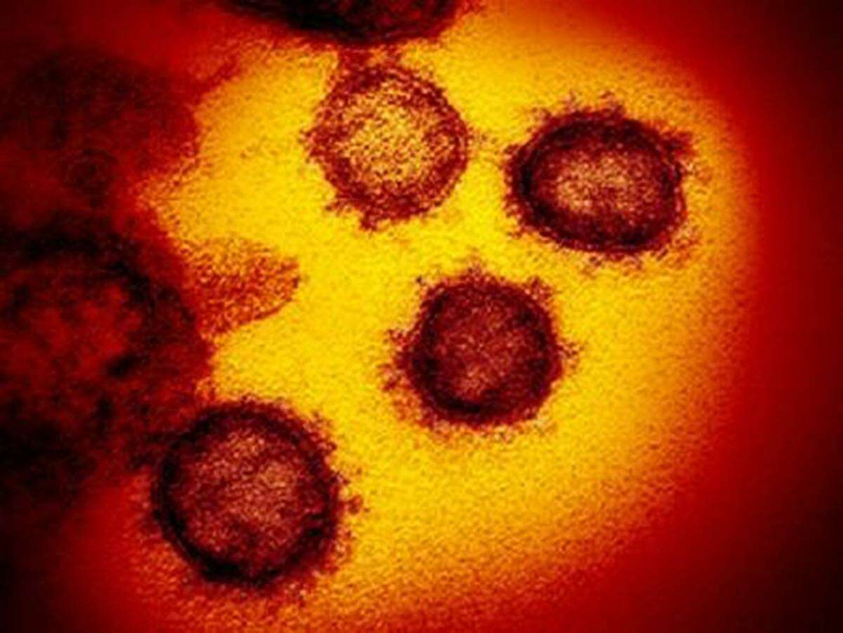 This transmission electron microscope image shows SARS-CoV-2, the virus that causes COVID-19, isolated from a patient in the United States, emerging from the surface of cells cultured in the lab.