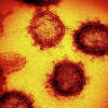 COVID-19: An undated photo provided by the National Institutes of Health, a transmission electron microscope image of 2019-nCoV, the virus that causes COVID-19, isolated from a patient in the United States emerging from the surface of cells cultured in a lab.