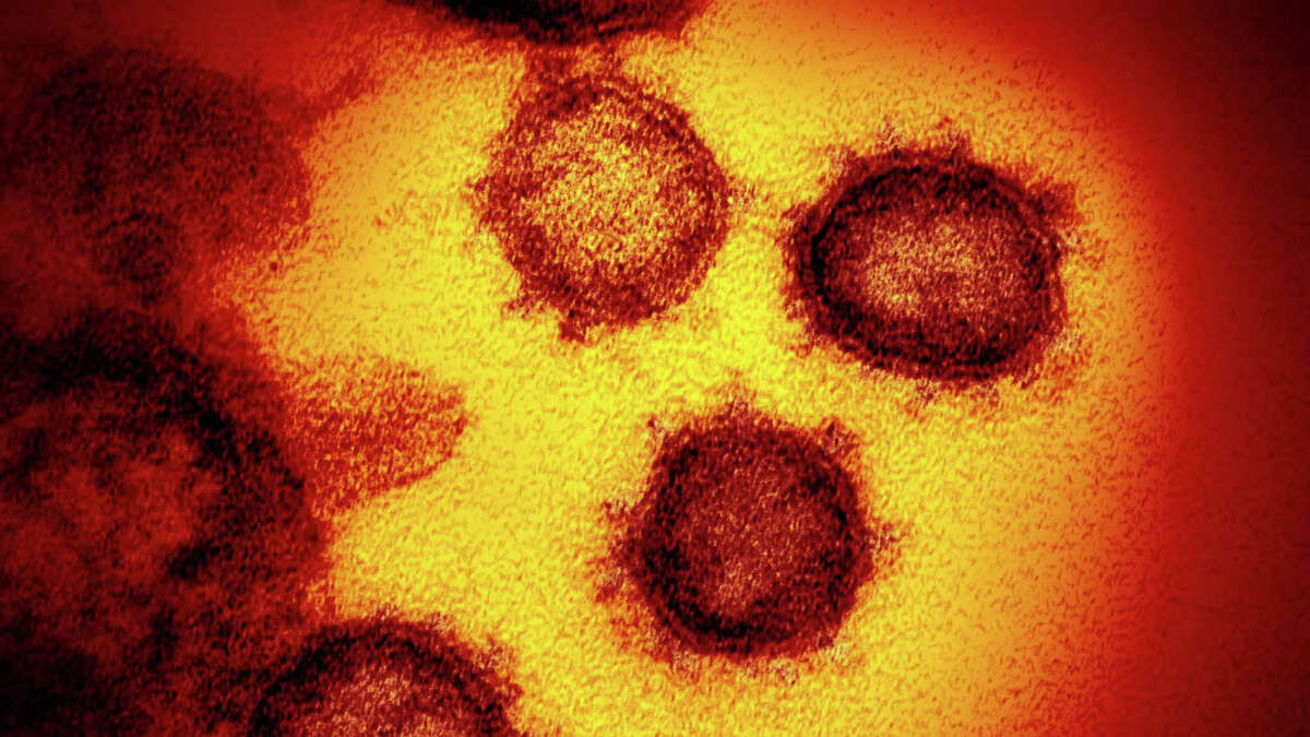 COVID-19: An undated photo provided by the National Institutes of Health, a transmission electron microscope image of 2019-nCoV, the virus that causes COVID-19, isolated from a patient in the United States emerging from the surface of cells cultured in a lab.