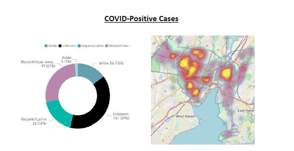 The percentage of hospitalizations for COVID-19 cases in New Haven is highest among African-Americans, followed by Hispanic and then by white residents, according to Mayor Justin Elicker