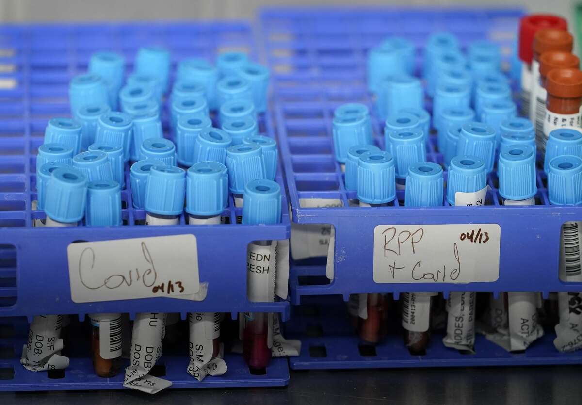 Trays of specimens for COVID-19 virus testing are shown at Altru Diagnostics Monday, April 13, 2020, in Houston.