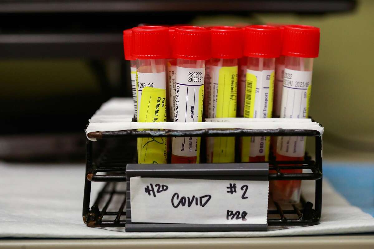 Bay Area coronavirus testing to soar with new Kaiser lab under construction
