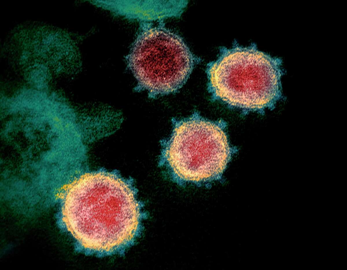 This handout illustration image obtained recently courtesy of the National Institutes of Health shows a transmission electron microscopic image that shows SARS-CoV-2also known as 2019-nCoV, the virus that causes the disease COVID-19, isolated from a patient in the U.S, as the virus particles are shown emerging from the surface of cells cultured in the lab, the spikes on the outer edge of the virus particles give coronaviruses their name, crown-like. Connecticut state Representative, Lucy Dathan, whose district represents parts of New Canaan has just the information about COVID-19, that residents of the town may need to deal with its crisis.