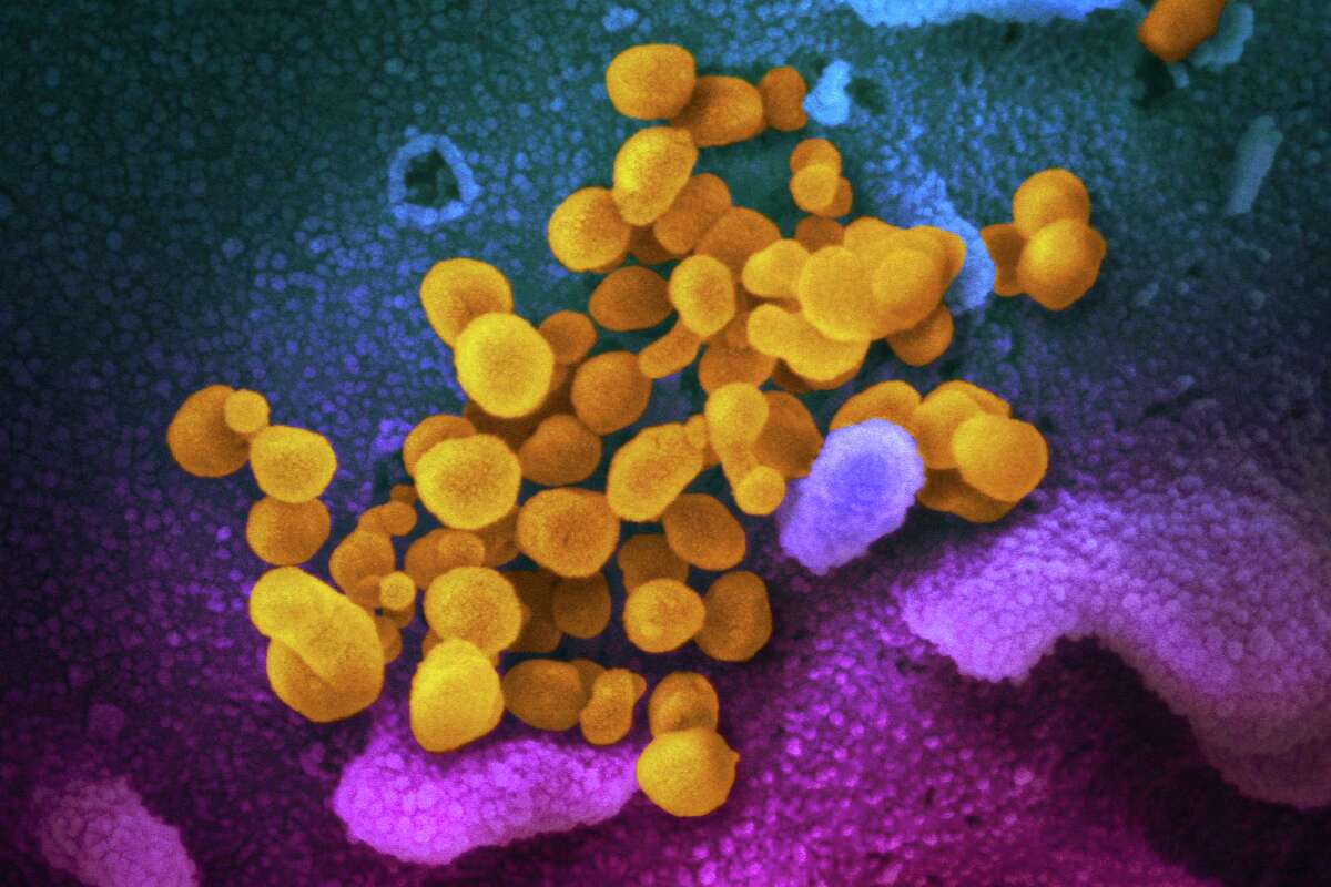 This undated electron microscope image made available by the U.S. National Institutes of Health shows the Novel Coronavirus SARS-CoV-2, yellow, emerging from the surface of cells, blue/pink, cultured in the lab.