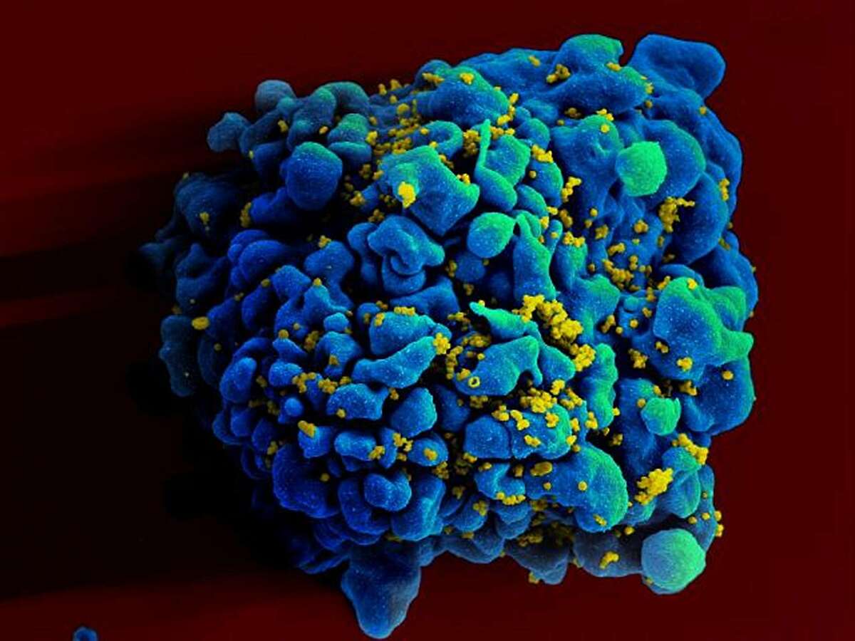 FILE - This April 12, 2011 electron microscope image made available by the National Institute of Allergy and Infectious Diseases shows an H9 T cell, blue, infected with the human immunodeficiency virus (HIV), yellow. Research suggests that a shot every one to three months may someday give an alternative to the daily pills that some people take now to cut their risk of getting HIV from sex with an infected partner. An experimental drug given in periodic shots completely protected monkeys from infection in two studies reported at an AIDS conference on Tuesday, March 4, 2014. (AP Photo/NIAID)