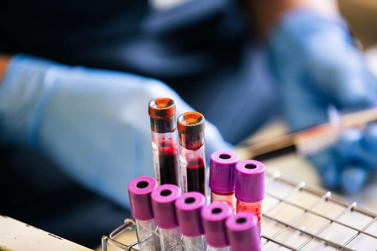 Vials of blood samples are seen on a rack during a baseline visit for a UCSF study to better understand the virus' effect on the human body after recovery, at the Zuckerberg San Francisco General Hospital and Trauma Center in San Francisco, on May 22, 2020.