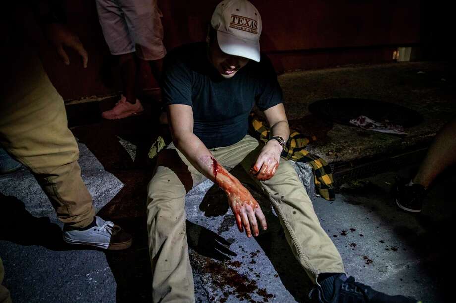Alex Lence, 23, bleeds from being shot by a non-lethal projectile by San Antonio Police. Photo: Matthew Busch, Contributor / For The San Antonio Express-News / **MANDATORY CREDIT FOR PHOTOG AND SAN ANTONIO EXPRESS-NEWS/NO SALES/MAGS OUT/TV