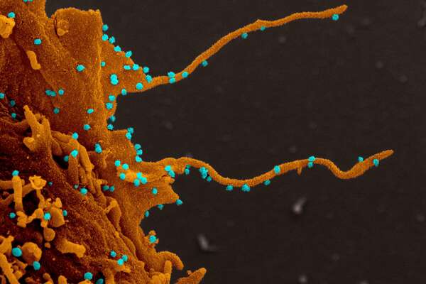 A member of the UCSF-led coronavirus research team captured these striking images with an electron microscope. They show African green monkey cells infected with the virus, revealing that the virus creates stringy structures called filopodia that poke holes in the cell and fill up with viral particles that “bud” out to infect other cells. The images are some of the clearest yet that show how the virus takes over its host and reprograms it to replicate and spread.