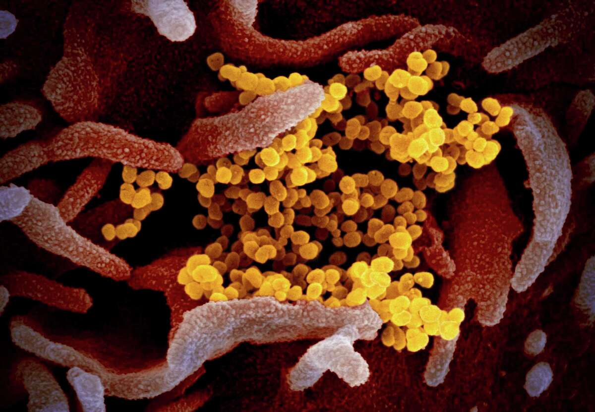 This electron microscope image made available by the U.S. National Institutes of Health in February 2020 shows the novel coronavirus SARS-CoV-2, yellow, emerging from the surface of cells, pink, cultured in the lab. The sample was isolated from a patient in the U.S. (NIAID-RML via AP)