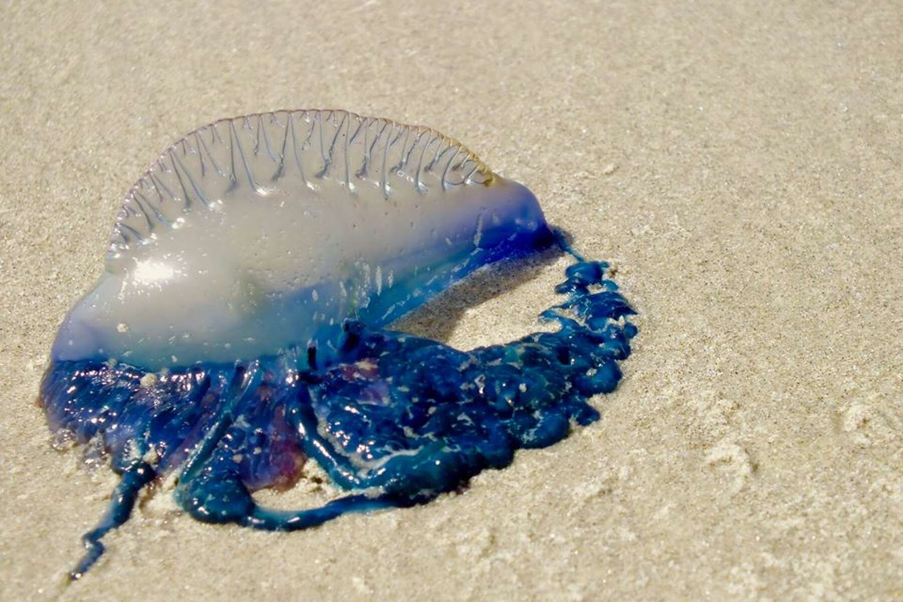 blue jellyfish sting