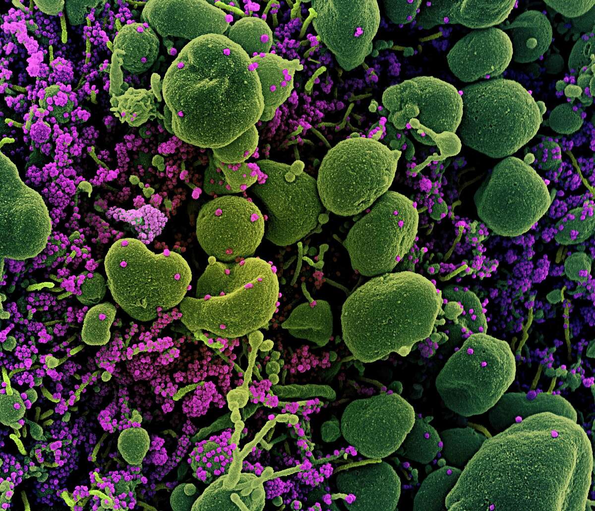 (FILES) This file undated handout image obtained July 15, 2020, courtesy of National Institute of Allergy and Infectious Diseases(NIH/NIAID), shows a colorized scanning electron micrograph of an apoptotic cell (green) heavily infected with SARS-CoV-2 virus particles (purple), isolated from a patient sample, captured at the NIAID Integrated Research Facility (IRF) in Fort Detrick, Maryland. - Wall Street stocks opened higher on August 5, 2020, extending a positive run on anticipation of more fiscal stimulus from Washington and progress on vaccines for the coronavirus pandemic. About 30 minutes into trading, the Dow Jones Industrial Average was up 1.0 percent at 27,097.60. The broad-based S&P 500 gained 0.6 percent to 3,325.52, while the tech-rich Nasdaq Composite Index climbed 0.3 percent to 10,978.77. The Nasdaq has ended at records the last two days.The US added a disappointing 167,000 private sector jobs in July, much below the level of the last two months and suggesting the recovery has slowed, according to payrolls firm ADP.Sentiment was also boosted by signs of forward movement on vaccines. (Photo by Handout / National Institute of Allergy and Infectious Diseases / AFP) / RESTRICTED TO EDITORIAL USE - MANDATORY CREDIT "AFP PHOTO /NATIONAL INSTITUTE OF ALLERGY AND INFECTIOUS DISEASES/HANDOUT " - NO MARKETING - NO ADVERTISING CAMPAIGNS - DISTRIBUTED AS A SERVICE TO CLIENTS (Photo by HANDOUT/National Institute of Allergy an/AFP via Getty Images)