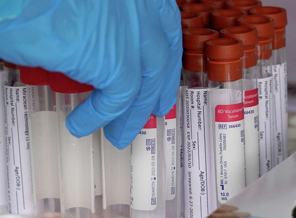 Vials used in COVID-19 testing are shown at a free site conducted by United Memorial Medical Center at the Consulate General Of Mexico, 4506 Caroline St., Sunday, June 28, 2020, in Houston.