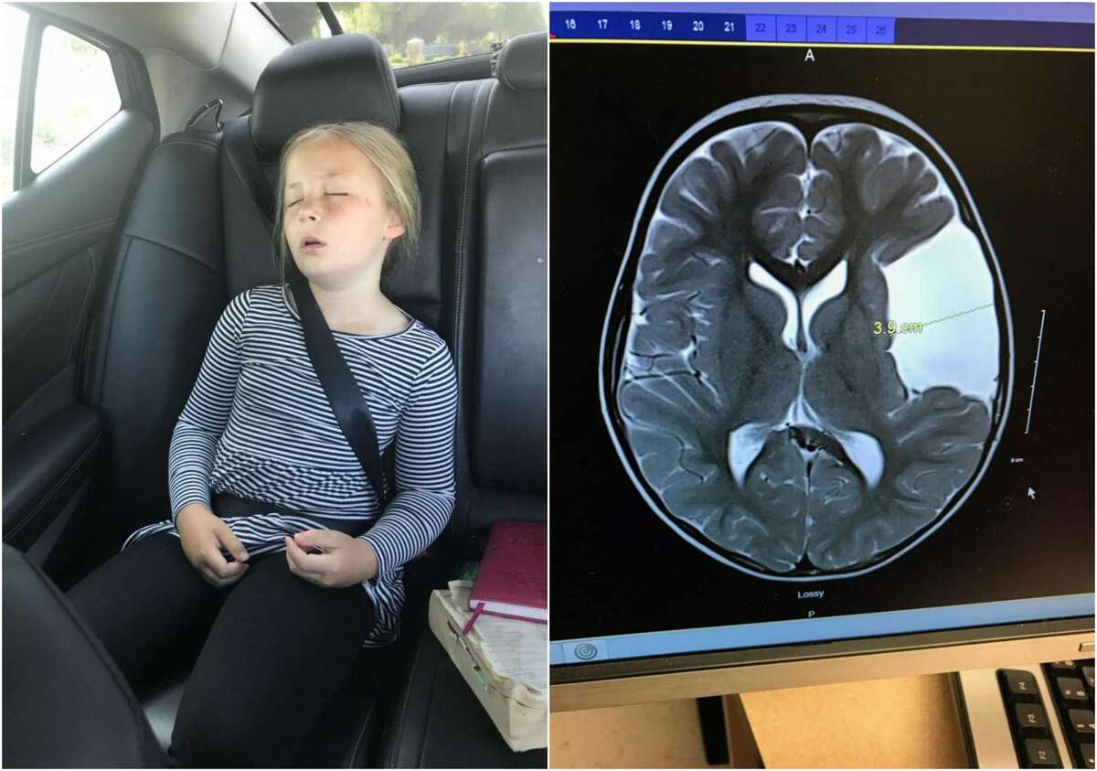 Tobin Hoagland, 9, lives in Boise, Idaho. But when her mom found a Houston surgeon who could help treat the cyst in her brain, the family drove 28 hours straight to Houston for an emergency surgery.