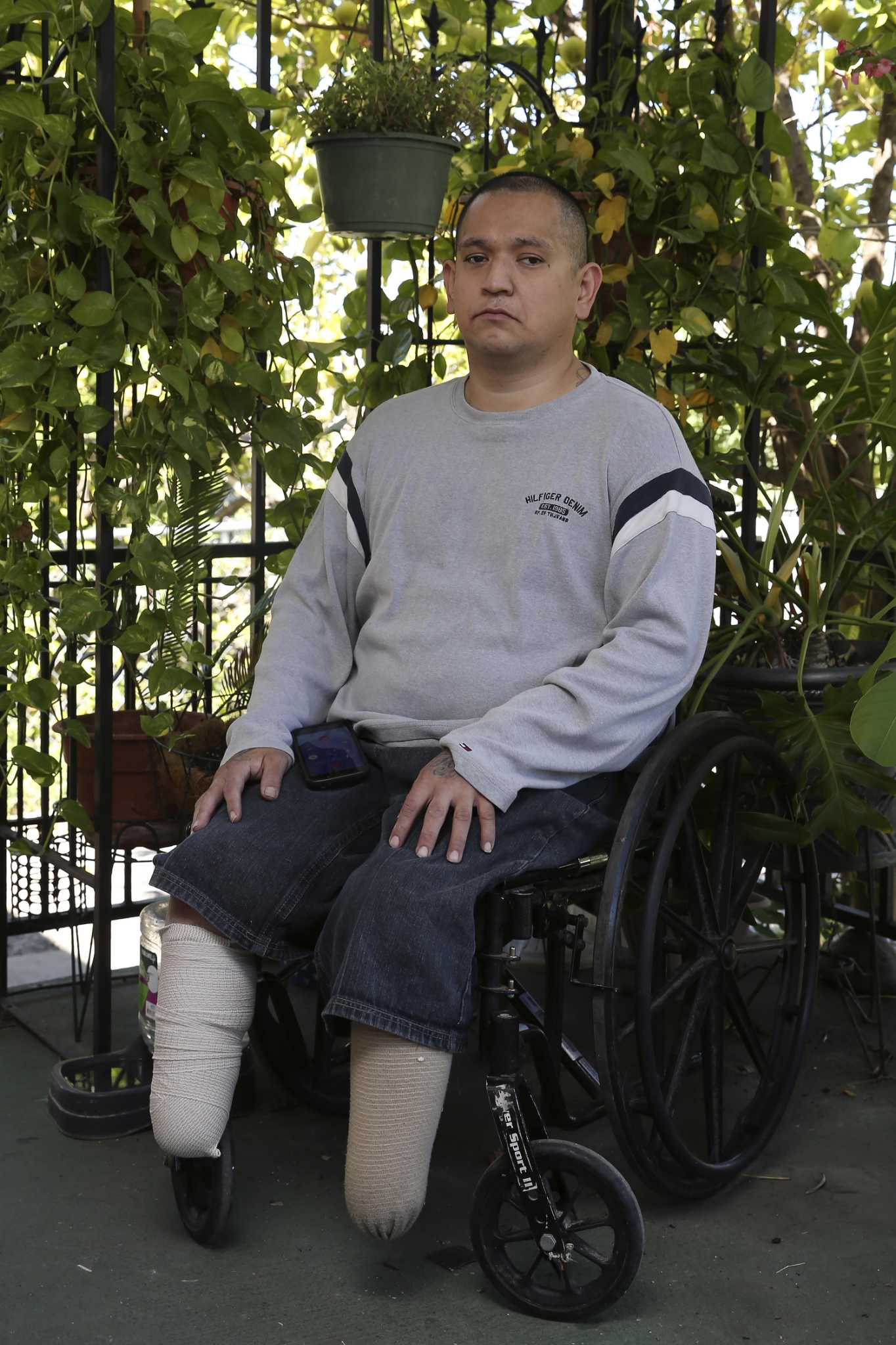 San Antonio meat cutter sues former employer over leg amputations